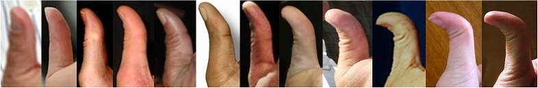 twelve thumbs